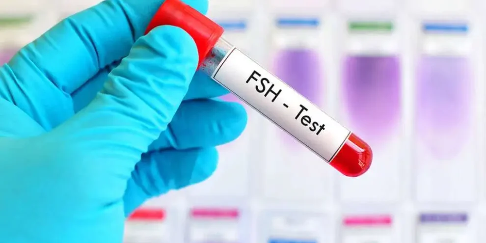 Why is FSH Testing Done?