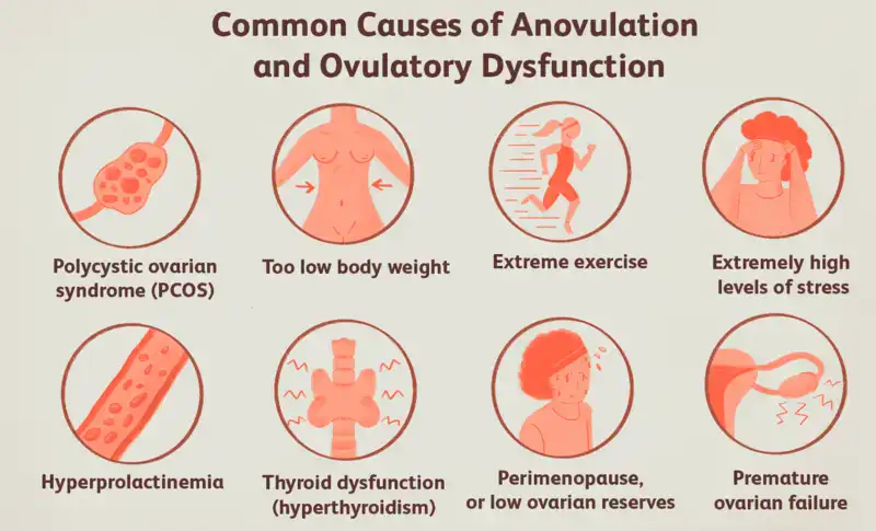 Ovulatory Dysfunction Causes
