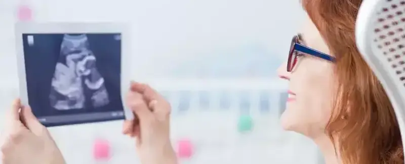 IVF Treatment Istanbul Turkey age limit