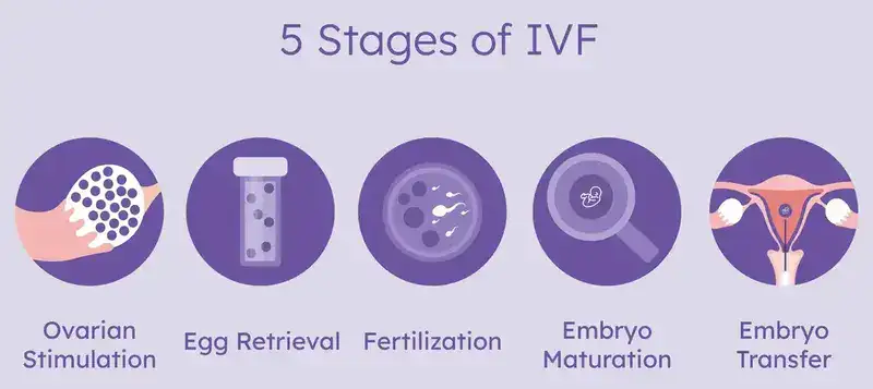IVF Treatment Istanbul Turkey stages