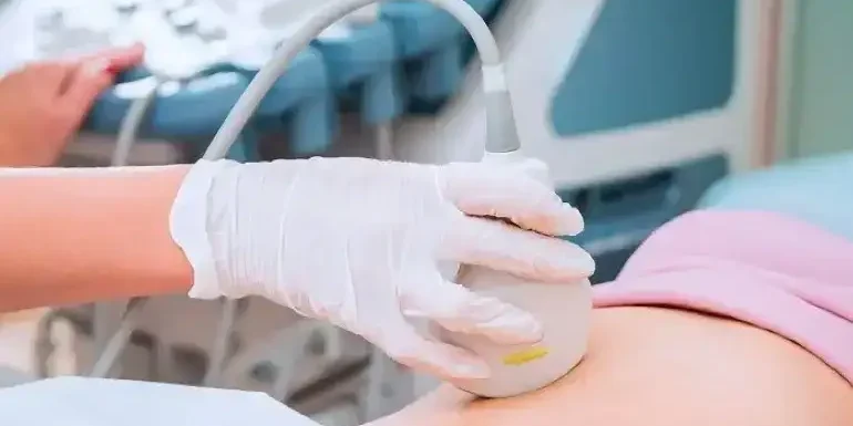 Risk of Ectopic Pregnancy in IVF