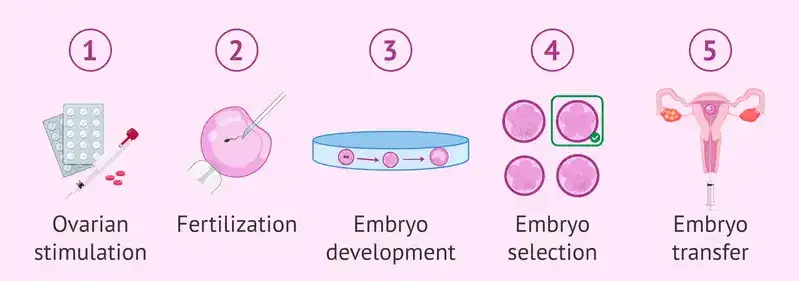 What is IVF Treatment prosess